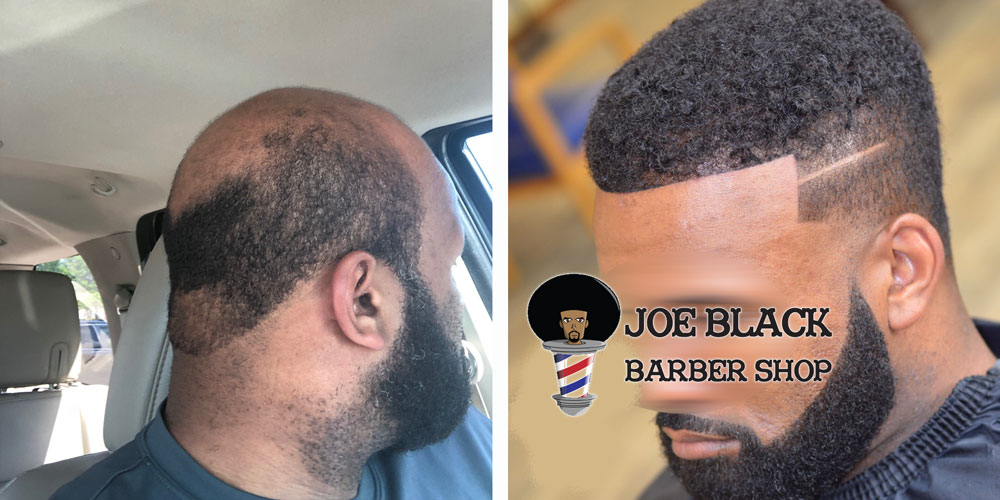 Men S Hair Replacement Services In Houston Tx Joe Black Barbershop