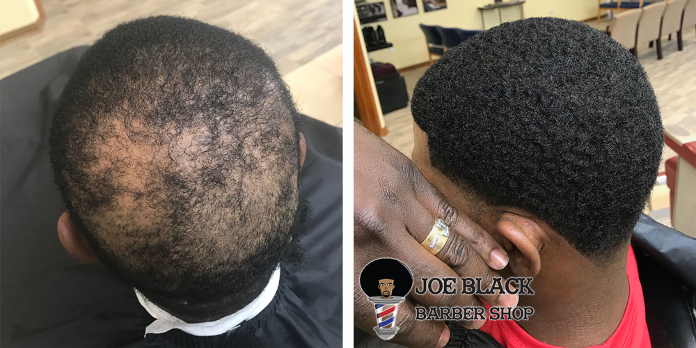 Joe Black Barbershop Hair Replacement Unit